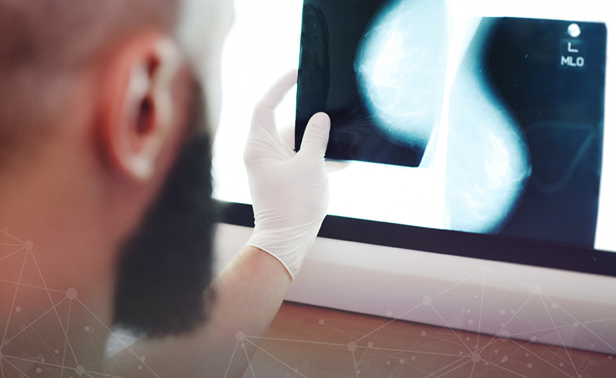 Google AI potrafi błyskawicznie wykryć raka piersi tylko na podstawie zdjęcia rentgenowskiego